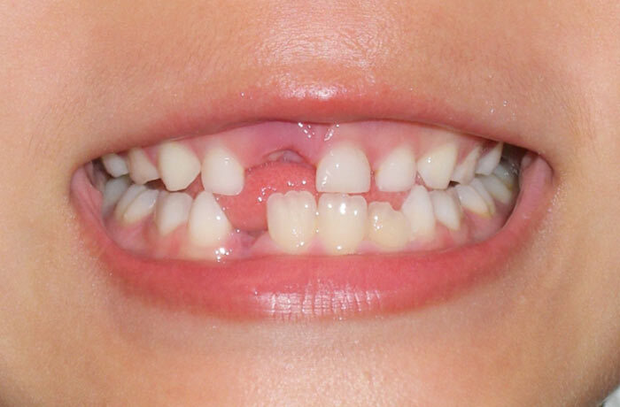 blog_2506_3_minorinodc