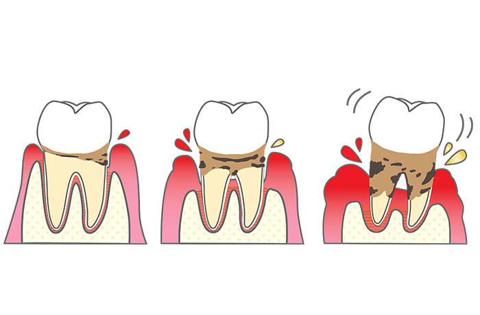 blog_2507_2_2_minorinodc