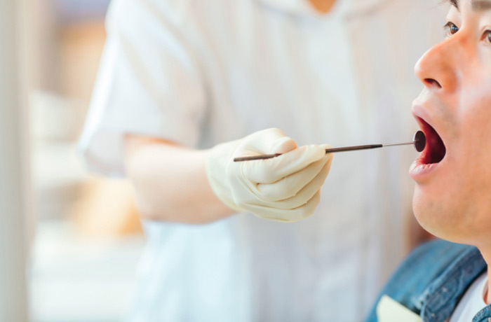 歯科医院でお口のチェックを受ける男性患者