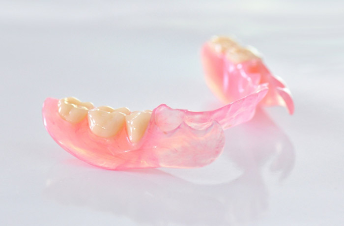 透明感のある美しいノンクラスプデンチャー