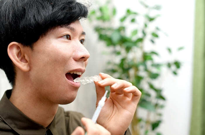 自宅でホームホワイトニング用のマウスピースを装着する男性の写真